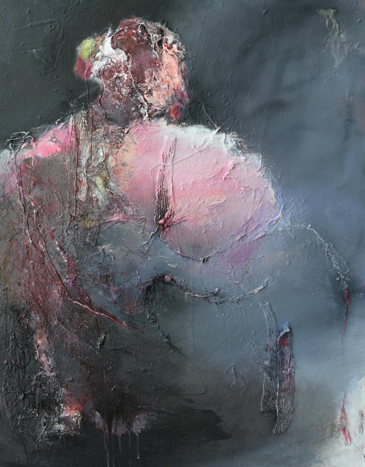 See "Réduire la fracture" of Denis Denis blondel